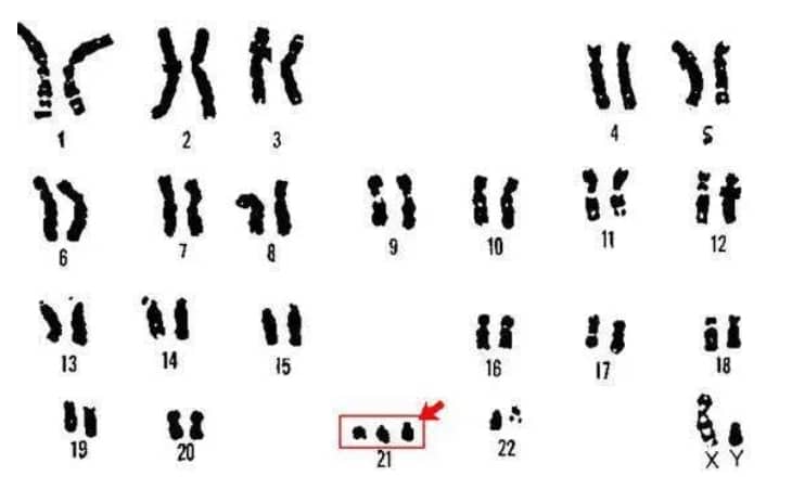 男方在試管前需要做哪些準備？